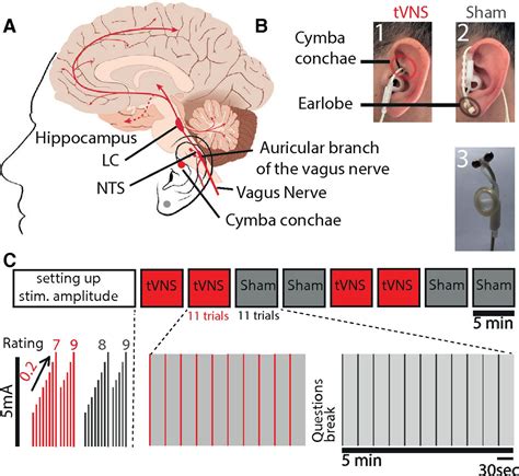 [PDF] Vagus nerve stimulation attenuates the  